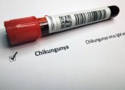 Kasus Suspek Chikungunya 2025 Melonjak, Kemenkes Waspada